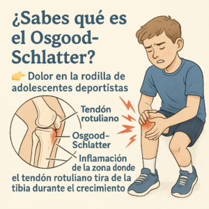 Lee más sobre el artículo Osgood-Schlatter en Madrid. Ignacio Lorente fisioterapia