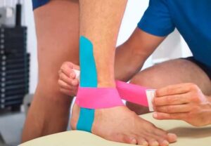 Lee más sobre el artículo Vendaje neuromuscular, lo que dice la evidencia (y lo que hacemos en Madrid)