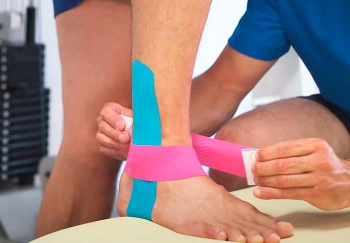 Lee más sobre el artículo Vendaje neuromuscular, lo que dice la evidencia (y lo que hacemos en Madrid)