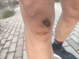 Lee más sobre el artículo Entrenar con dolor moderado: por qué muchos deportistas mejoran antes cuando no paran del todo